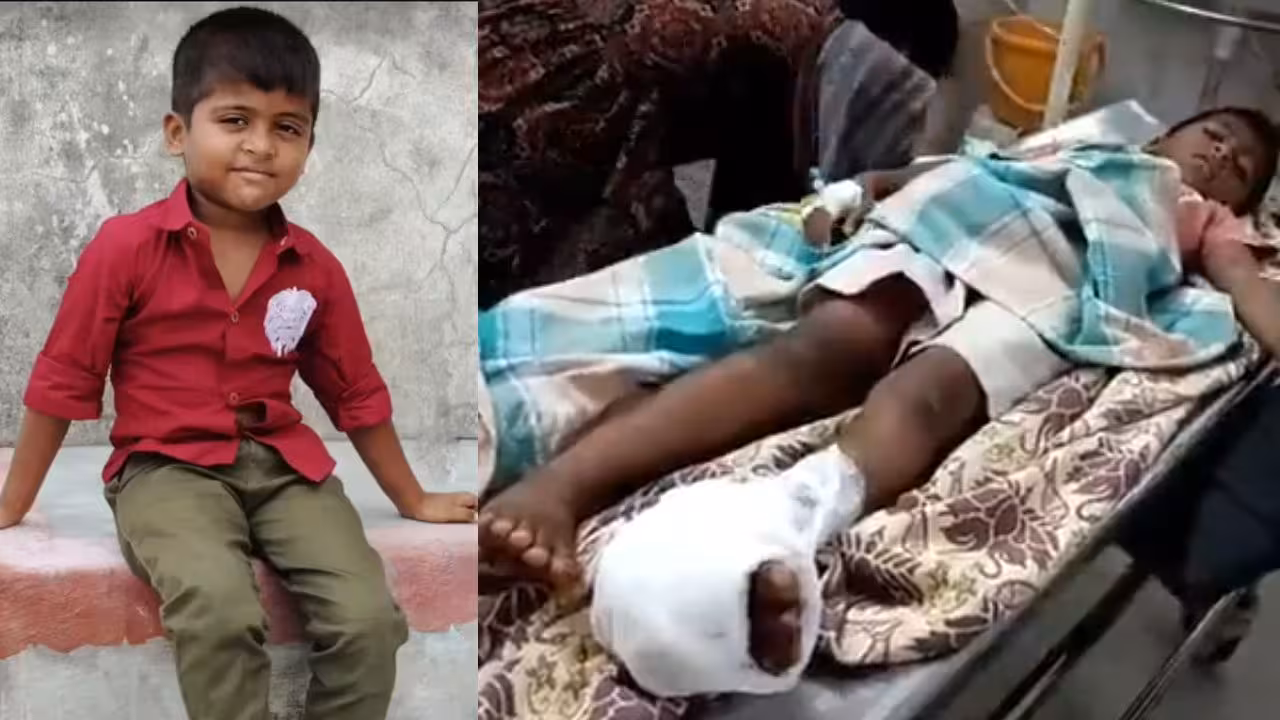 Medaram | మేడారం గద్దెల వద్ద జారిపడిన రాతిశిల.. బాలుడికి తీవ్ర గాయాలు