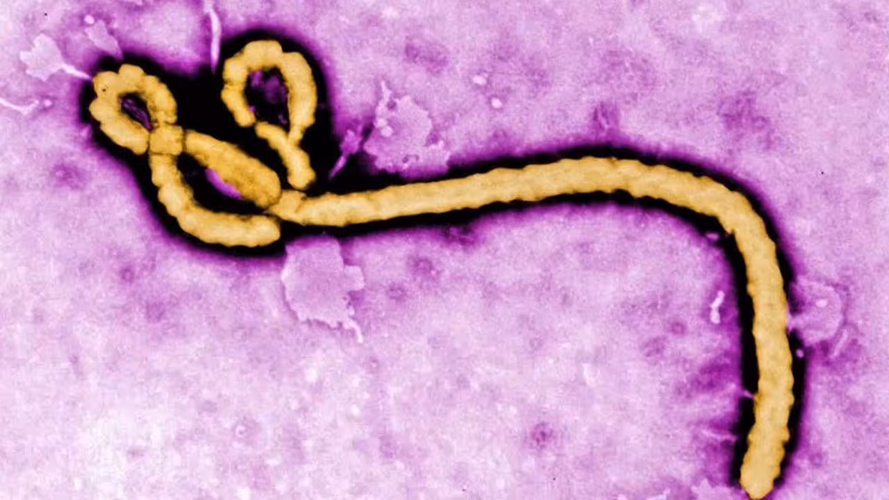 Ebola | హైదరాబాద్లో రెండుకు చేరిన ఎబోలా అనుమానితులు.. గాంధీ దవాఖానలో చికిత్స