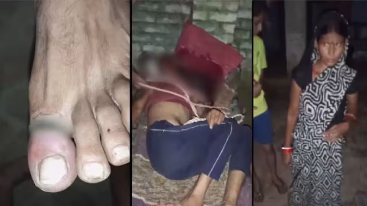 Electric Shocks | తాగొచ్చి గొడవ చేస్తున్నాడని.. భర్తను మంచానికి కట్టేసి కొట్టి.. కరెంటు షాక్ పెట్టి చిత్రహింసలు..