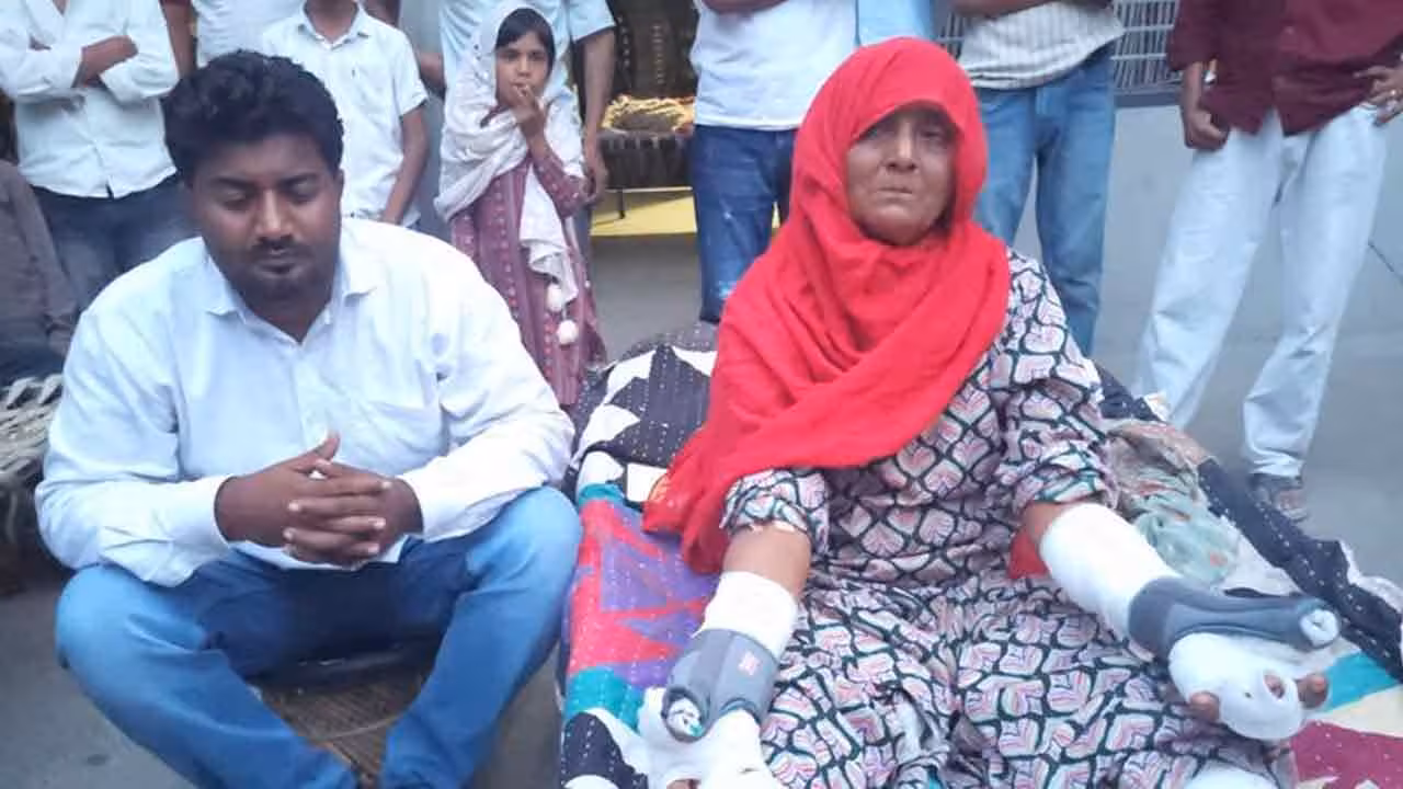 Woman fight with Jackal | నక్క బెదిరింపులకు వణకని 60 ఏళ్ల వృద్ధురాలు.. అరగంట పాటు వీరోచిత పోరాటం