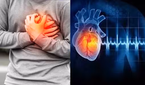 Heart Attack | హార్ట్ అటాక్, కార్డియాక్ అరెస్ట్ రెండూ ఒకటే కాదు.. తేడా తెలుసుకుంటే ప్రాణాలు కాపాడొచ్చు..
