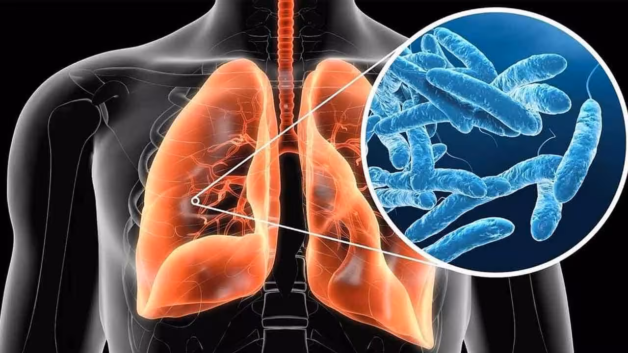 Legionnaires Disease | న్యూయార్క్లో విజృంభిస్తున్న లెజియోనెయర్స్ వ్యాధి.. అసలేంటిది.. ఎలా వ్యాపిస్తుంది..