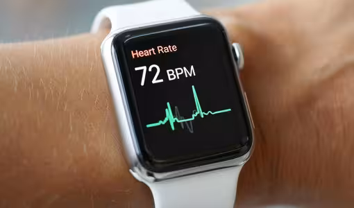 Smartwatch | స్మార్ట్ వాచ్ ధరిస్తే తలనొప్పి వస్తుందా..? వైద్యులు ఏం చెబుతున్నారు..?