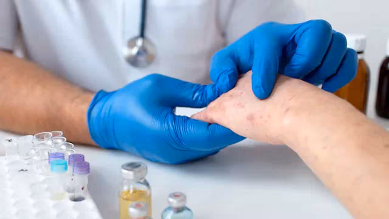 Measles | ప్రపంచవ్యాప్తంగా భారీగా పెరుగుతున్న మీజిల్స్ (తట్టు) కేసులు.. కారణాలేంటి..?