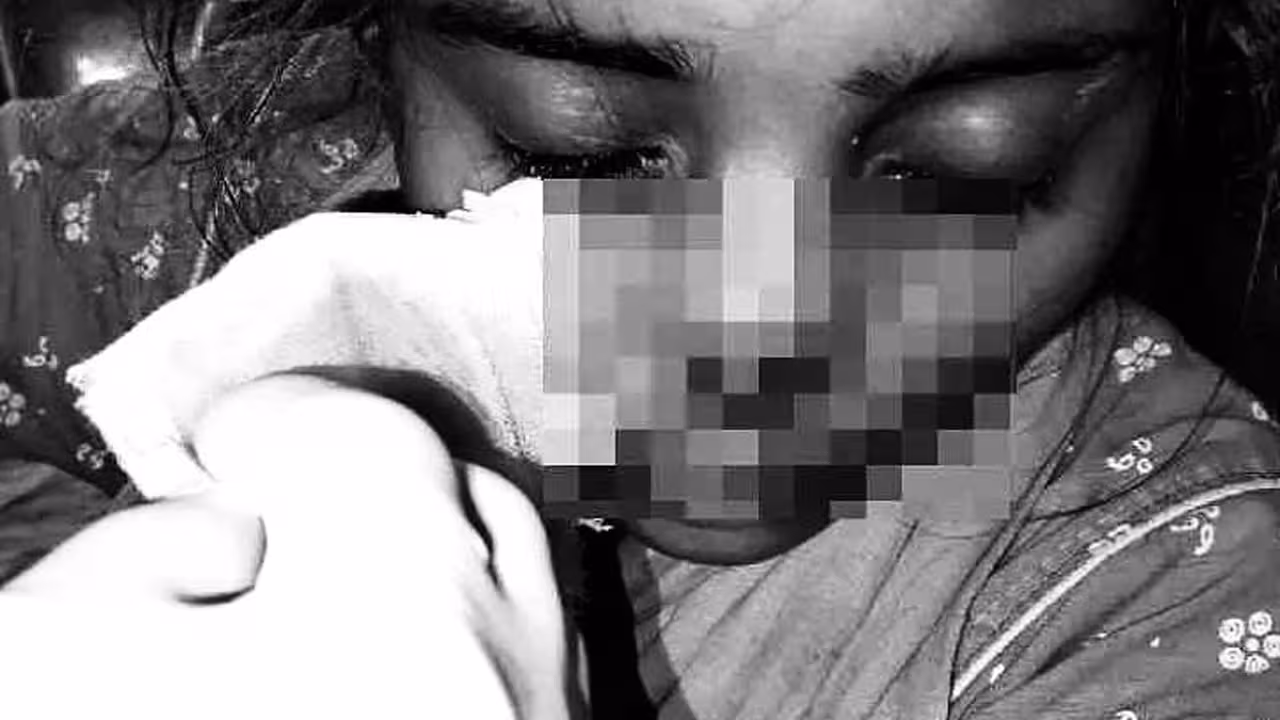 Man Bites Wife Nose | అరాచకం.. అదనపు కట్నం కోసం భార్య ముక్కు కొరికిన భర్త