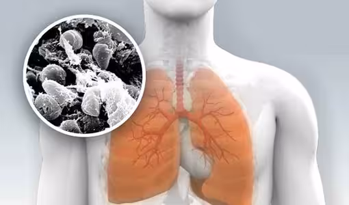 Pneumonic Plague | సైబీరియాలో న్యుమోనిక్ ప్లేగ్ క‌ల‌క‌లం.. ఏంటిది.. ఎలా వ్యాపిస్తుంది, ల‌క్ష‌ణాలు ఎలా ఉంటాయి..?